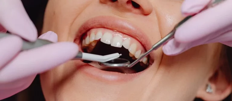 How to Get Rid of Swollen Gums