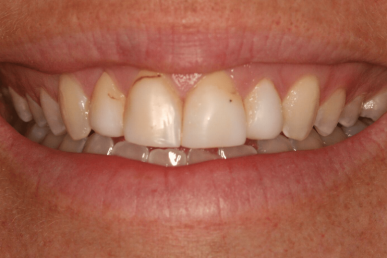 before dental treatment smile