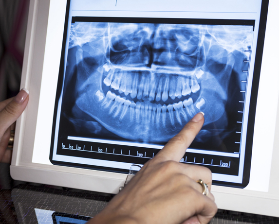 dentist looking at x-rays