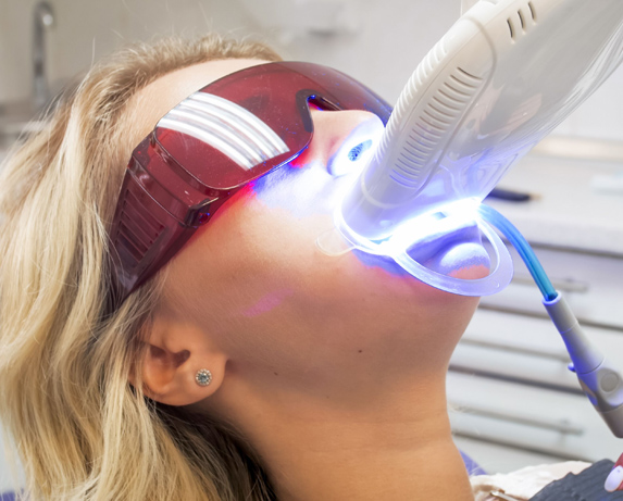 professional teeth whitening at the dentist