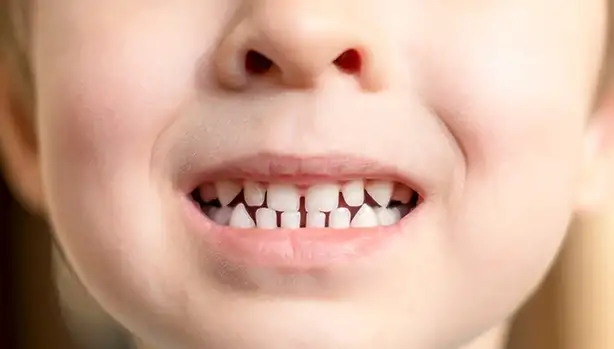 A child smiles with healthy teeth.
