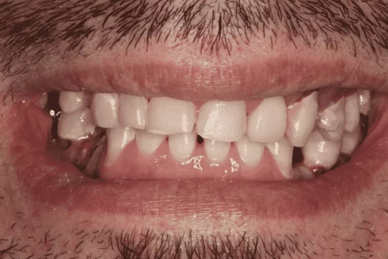 smile 1