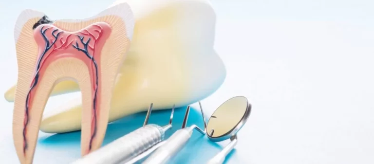 What’s Better for a Tooth Cavity? A Dental Filling or a Root Canal?
