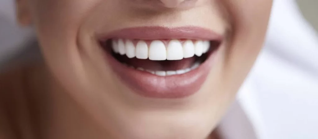What Should I Know About Teeth Whitening?