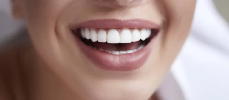 What Should I Know About Teeth Whitening?