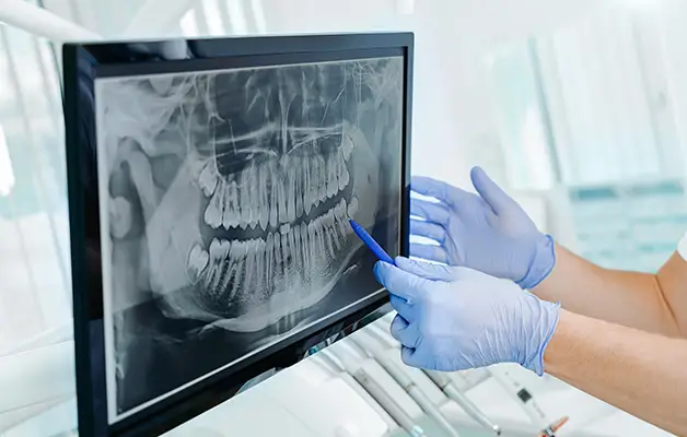 Dental x-ray