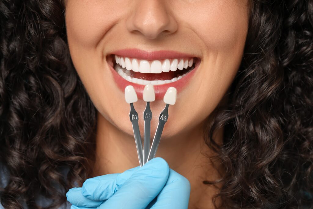 Custom dental restorations concept: three shades of teeth are held up against a woman's smile for comparison.
