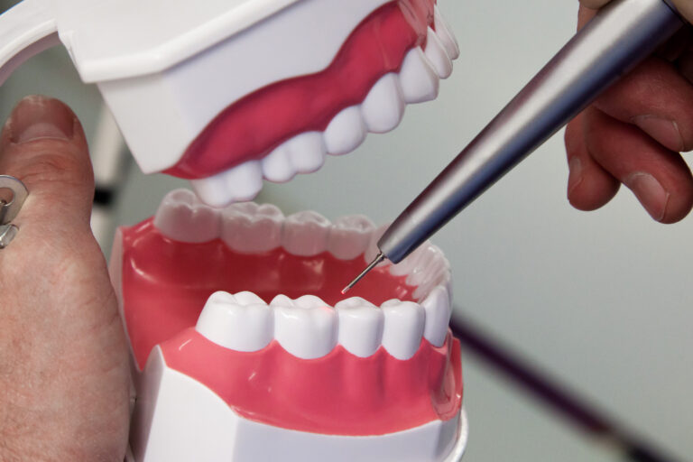 Modern dentistry concept: a laser tool is pointed at a prop mouth during a demonstration.