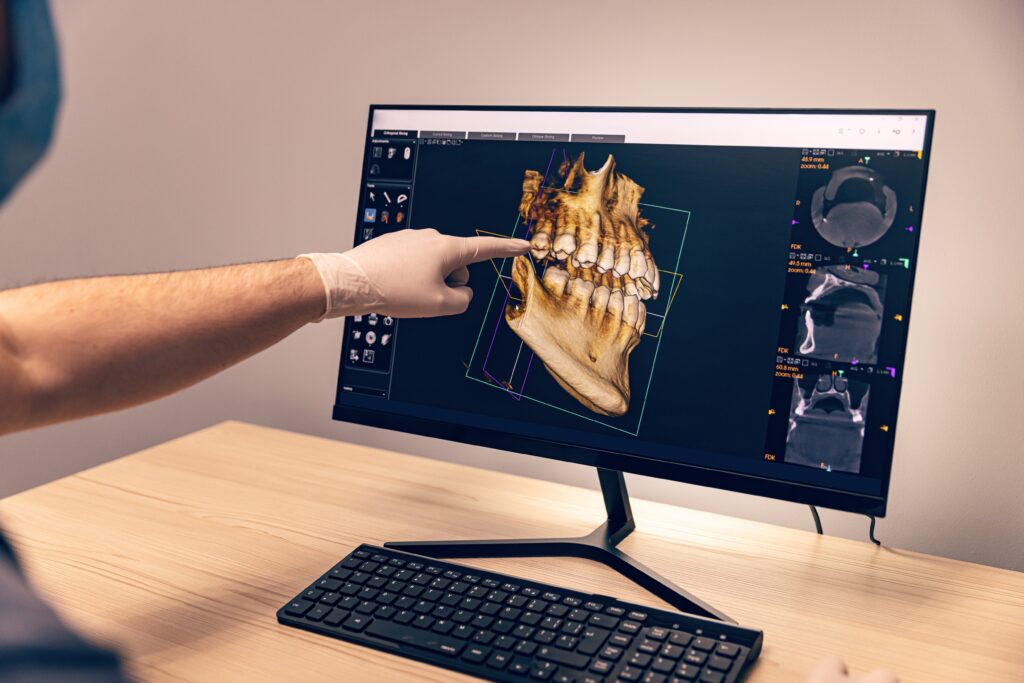 A dentist points to computer imaging of teeth on a monitor.