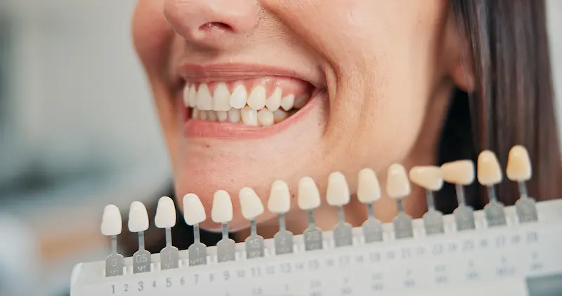 A woman smiles to compare her teeth to a row of the best dental implant options.