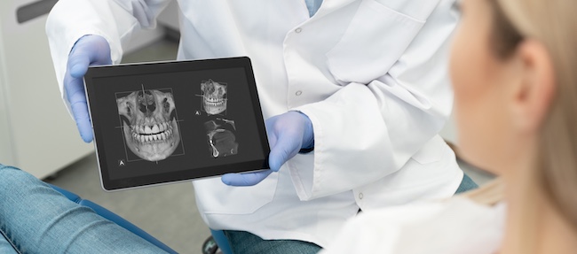 Dental X-Rays