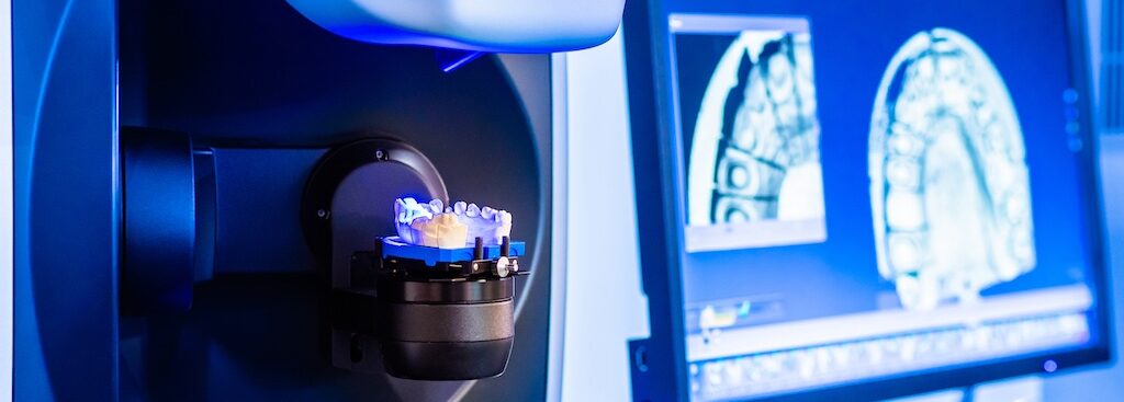 Dental Bridges