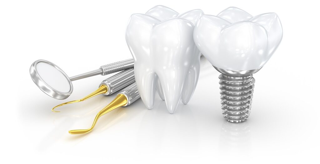 Dental Implants Hampton Coliseum