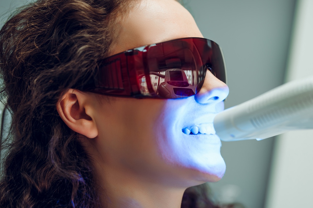 Teeth Whitening