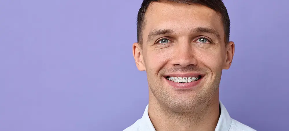 Man with Fastbraces