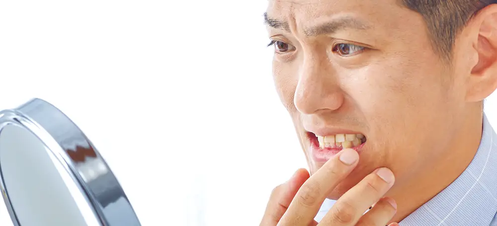 Man concerned about red gums