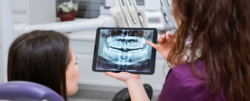 Tooth extraction consultation for impacted wisdom teeth
