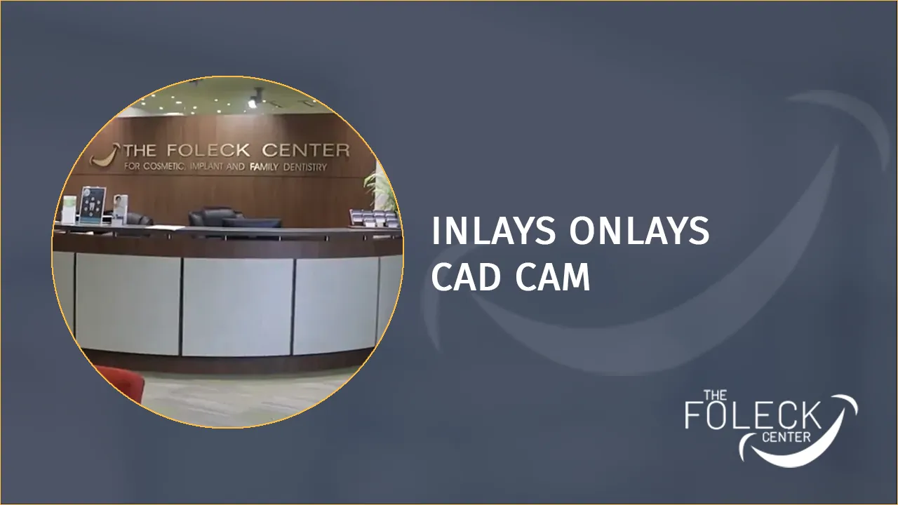 Inlays Onlays Cad Cam