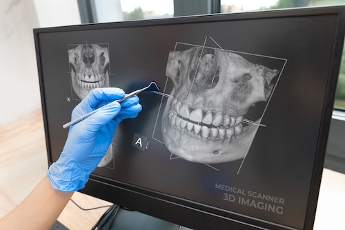3D Dental Imaging - Pearl AI 3D Imaging