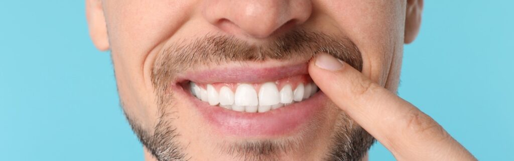 Smiling Caucasian man with a beard pointing to his perfect teeth on a teal background.