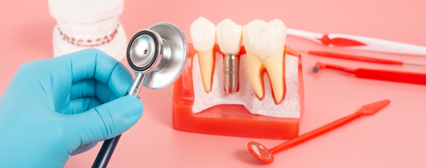A dentist in blue gloves is holding a stethoscope near a dental model and dentistry tools which are showing dental implants in Virginia at The Foleck Center.