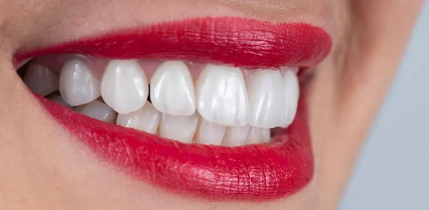 A close-up smile with bright white teeth and red lipstick showcases successful dental implant restoration results at The Foleck Center.