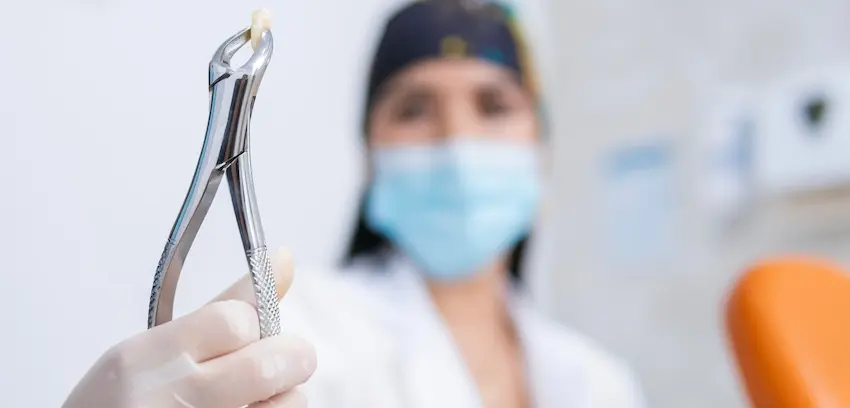 A masked dentist is holding extraction forceps with an extracted tooth which is demonstrating the tooth extractions procedure in a dental office at The Foleck Center in Virginia.