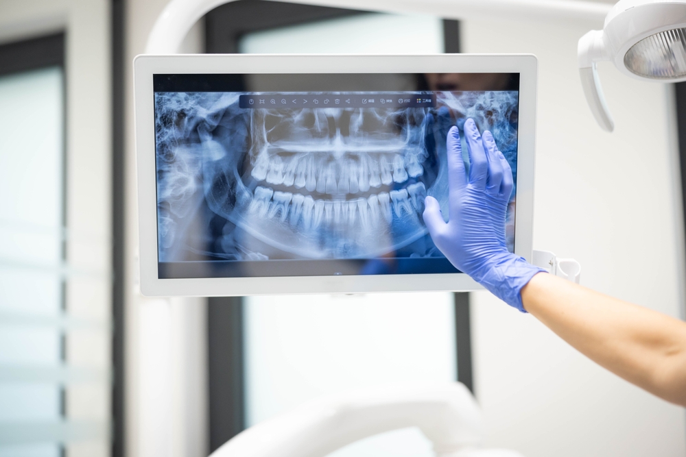A gloved hand closely interacts with a dental X-ray displayed on a screen, indicating a focused analysis or teaching moment in a dental office environment.