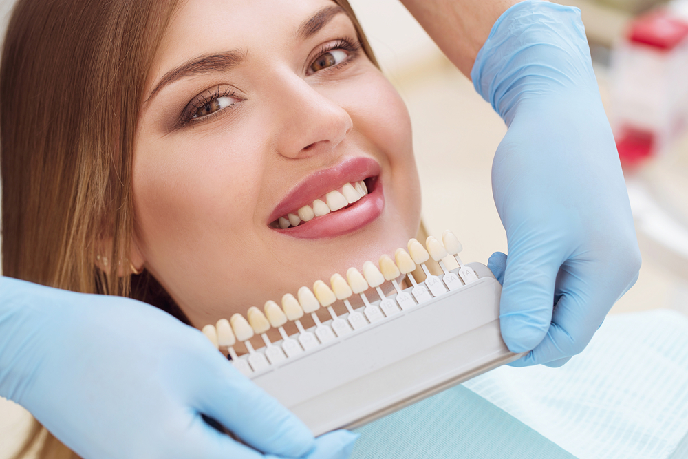 Beautiful european woman smile with healthy teeth whitening. Dental care concept. Set of implants with various shades of tone