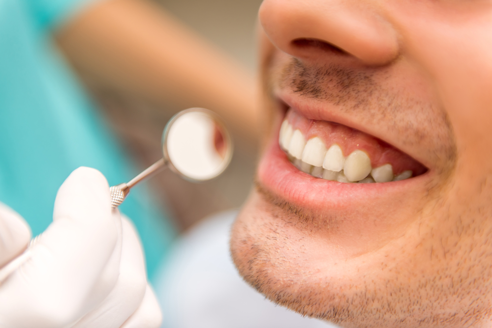 Close-up of a man's bright smile being checked with a dental mirror after a whitening visit in Norfolk 