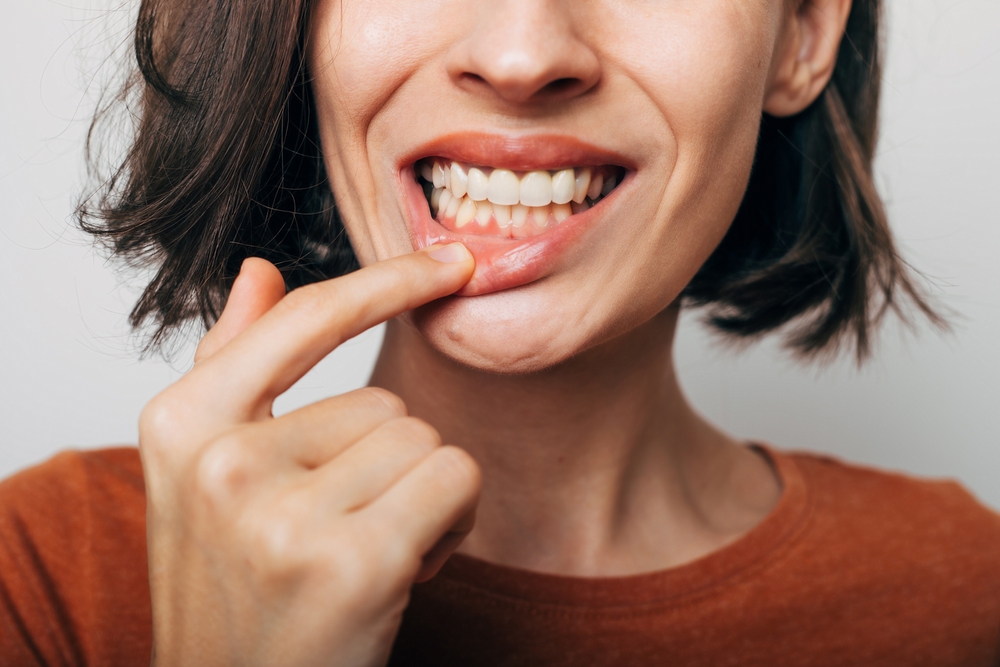 Woman pulling back the corner of her mouth to show her teeth and gums
