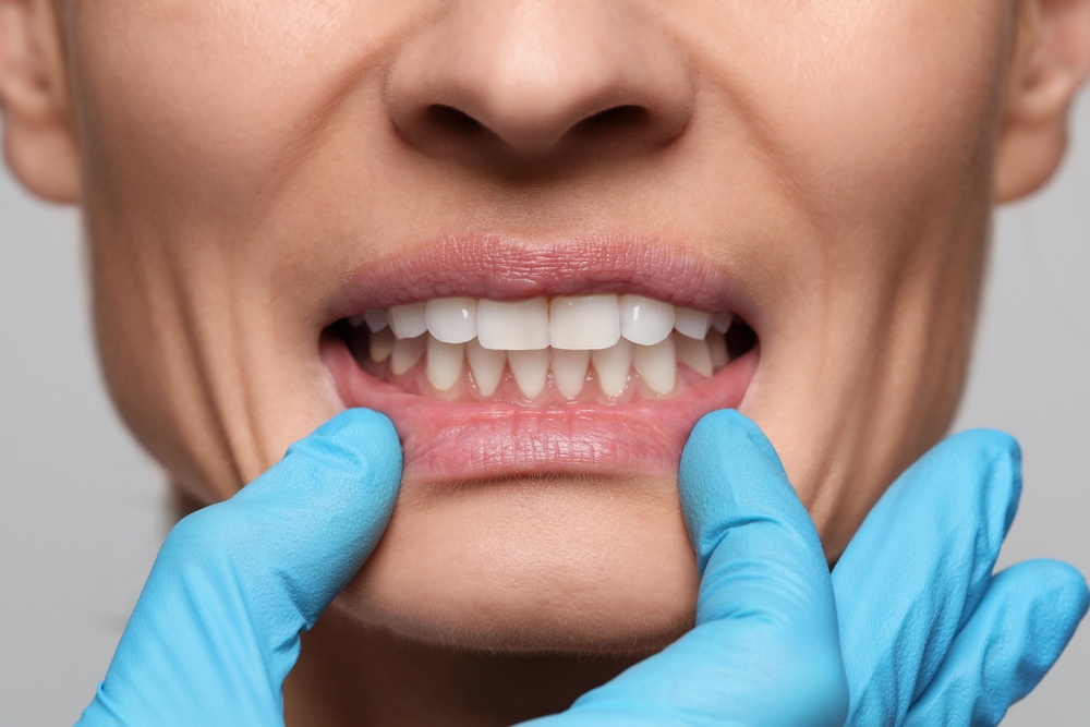 Dental provider in blue gloves pulling down a patient's lower lip to examine her gums