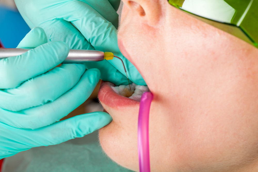 Dentist using a professional dental laser for oral treatment