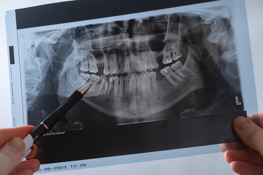 Doctor examines a dental X-ray to determine the best treatment approach for the patient.