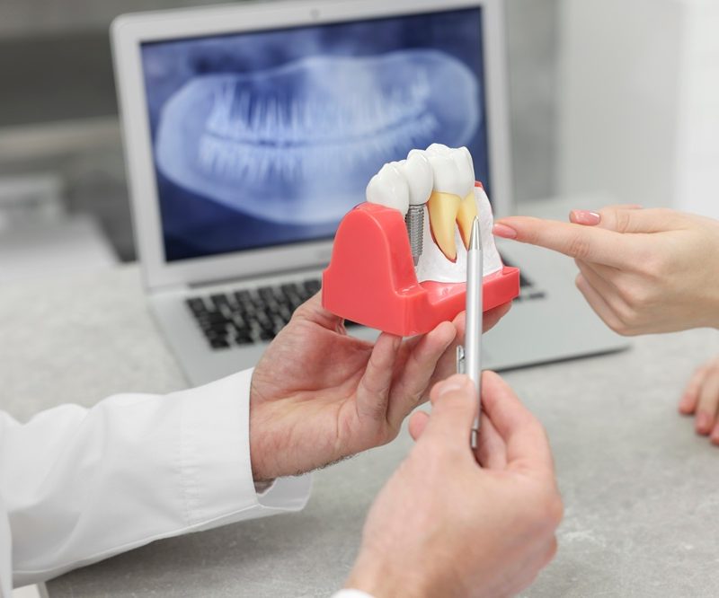 Dentist holding a dental implant model while a patient points to it, with a panoramic X-ray displayed on a laptop screen