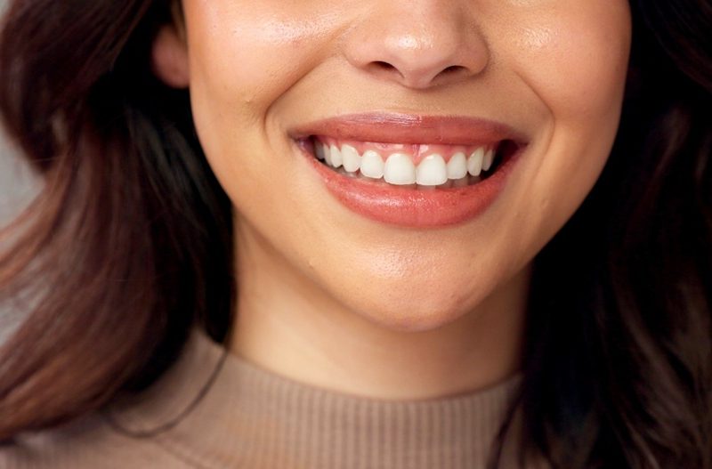 Close-up of a woman's smile showing straight, white teeth