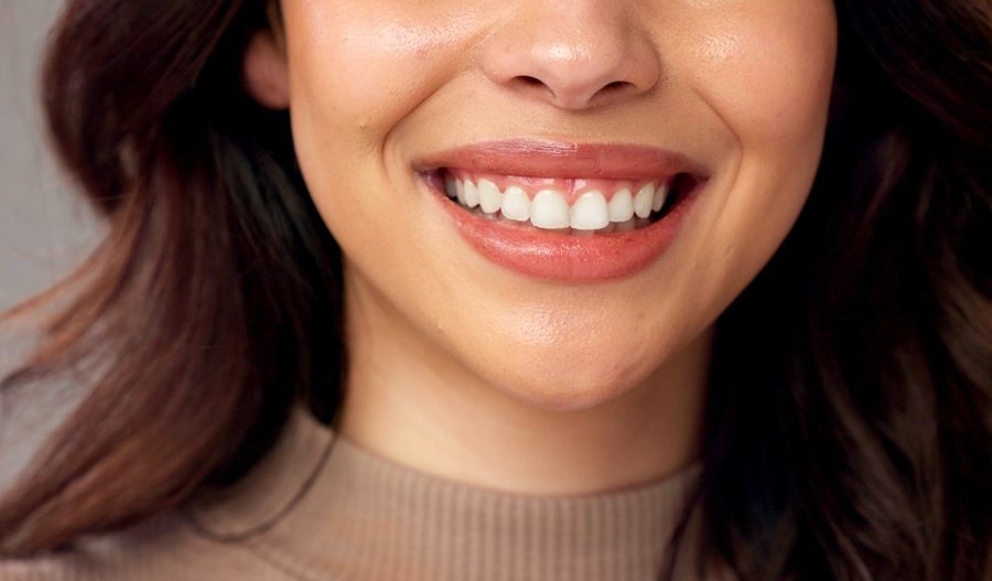Close-up of a woman's smile showing straight, white teeth