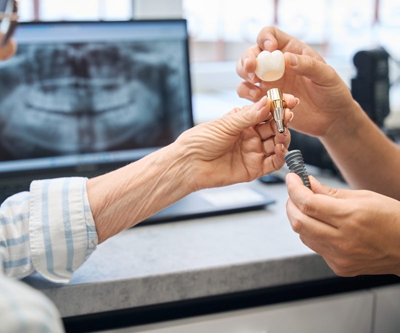 Older woman holding a dental implant crown while a provider holds implant screw components, with a panoramic X-ray on a laptop screen