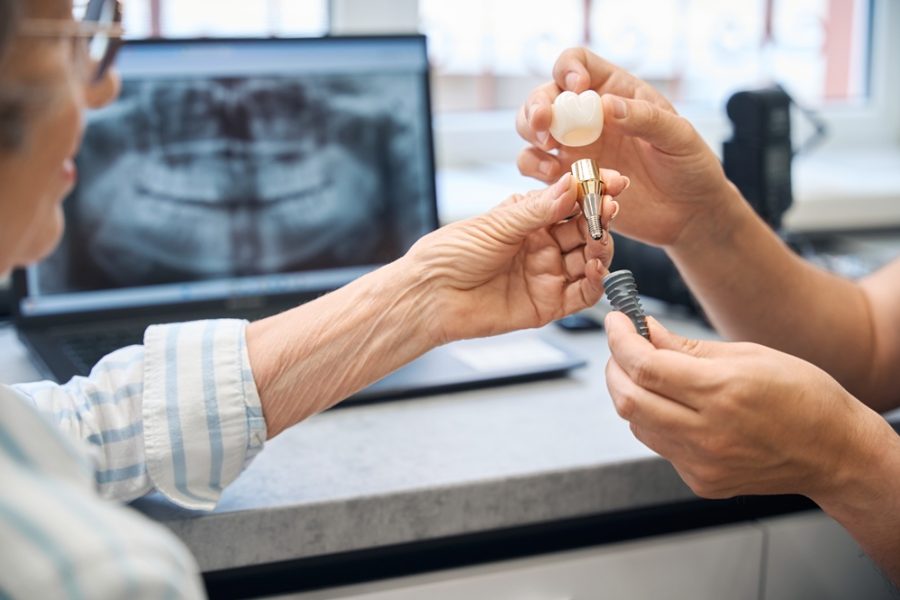 Older woman holding a dental implant crown while a provider holds implant screw components, with a panoramic X-ray on a laptop screen