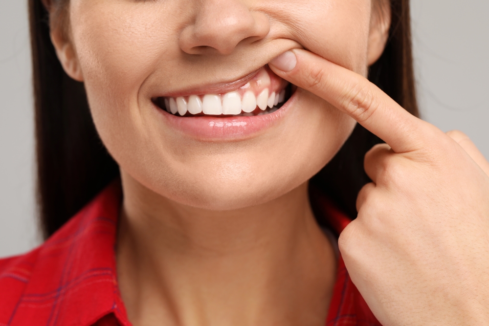 Woman showing her clean teeth on light grey background, closeup
