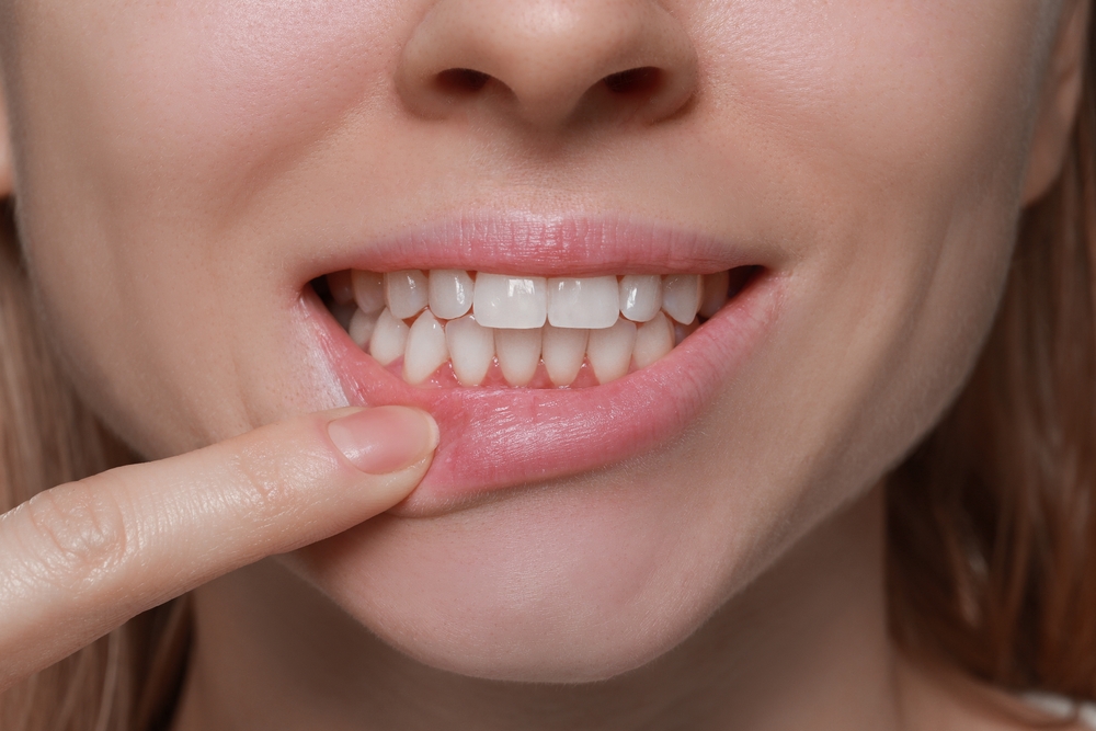 Checking for early signs of gingivitis Close-up of a woman pulling down her lower lip to check her gums and teeth