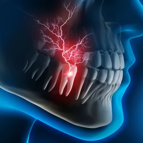 Stabbing tooth pain