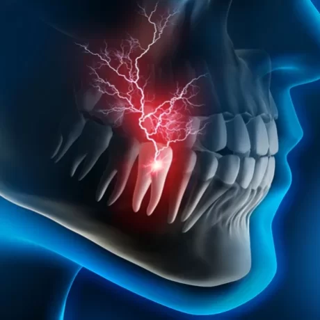 Stabbing tooth pain graphic used to identify dental emergencies handled by The Foleck Center Team.