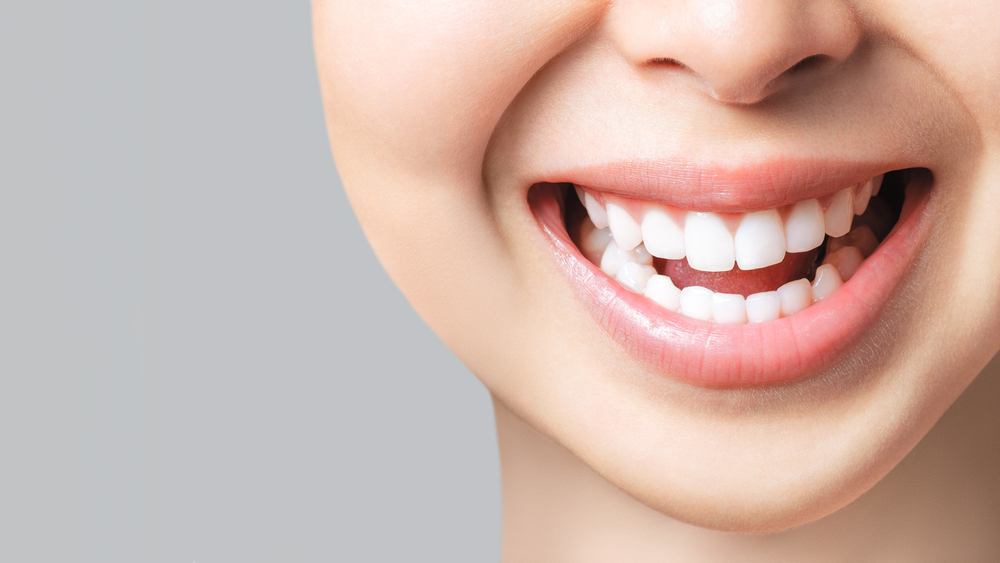 Healthy Smile Close-Up: Virginia Beach Smile Makeover Close-up of a healthy, bright smile achieved through a smile makeover in Virginia Beach
