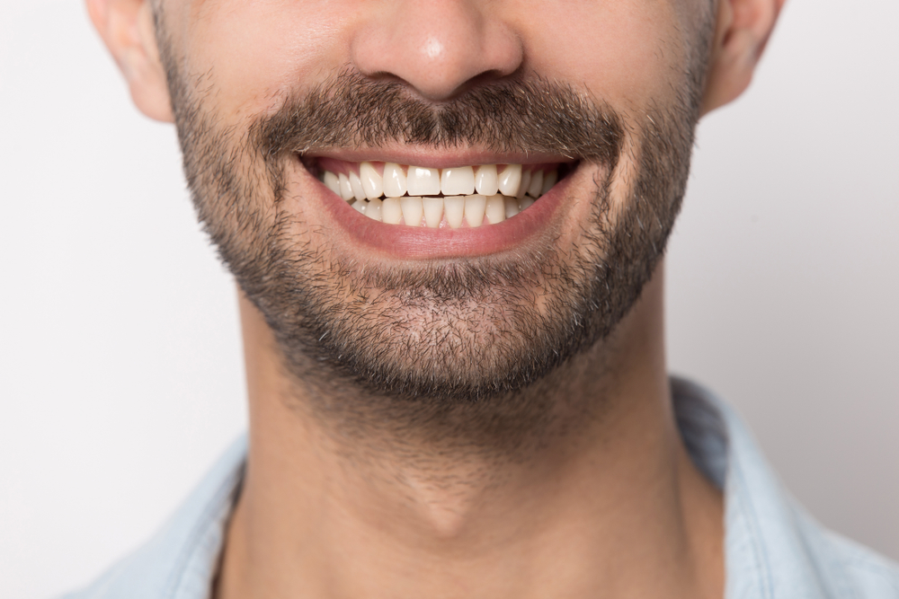 Close-up of a man's bright, straight smile, reflecting dental implant results at The Foleck Center, Norfolk, VA 