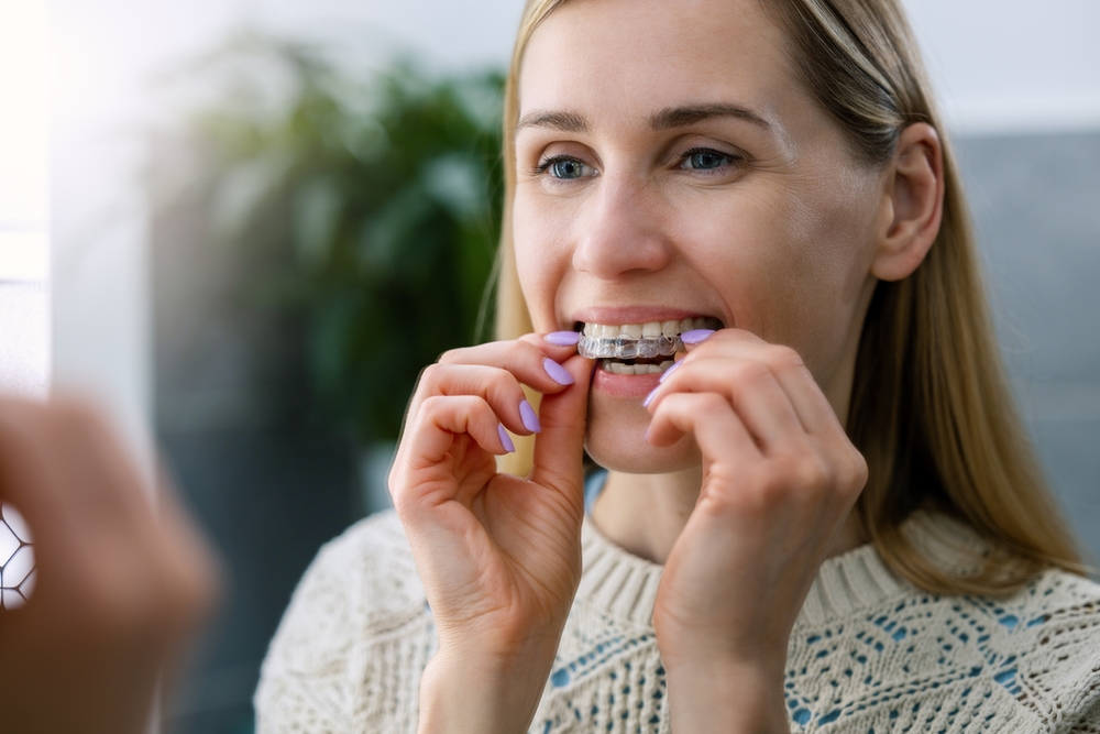  Woman inserting a clear aligner tray into her mouth while smiling